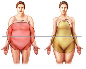 Типы ожирения