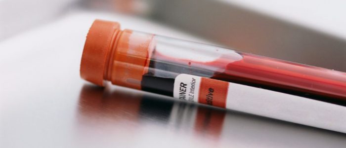 Анализ крови при лейкемии