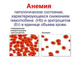 Анализы крови при лимфоме