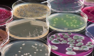 Что такое микробиологический анализ воды, как проводится отбор?