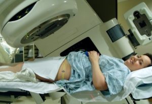 Стадии и лечение плоскоклеточного рака шейки матки